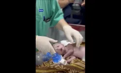 İşgalcilerin katlettiği Filistinli hamile kadının bebeğini Gazzeli doktorlar kurtardı