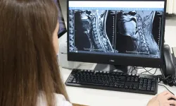 Uzmanından uyarı: Multiple Skleroz her hastada farklı seyrediyor