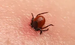 Yanlış müdahale ölümle sonuçlanabilir