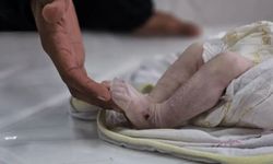 Gazze’de günde7 Filistinli açlıktan  ölüyor