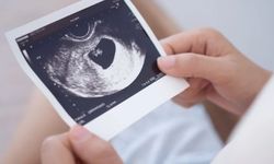 13 Haftalık Gebelikte Anne Ve Bebek: Neler Olur?