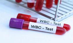 WBC Nedir? WBC Yüksekliği Ne Anlama Gelir?