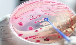 Sepsis her yıl 30 milyondan fazla insanı etkiliyor