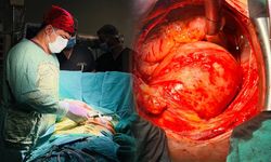 Van’da tıp tarihine geçen ameliyat! Tüm aort damarı değiştirildi