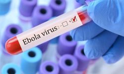 Ebola virüsü yayılıyor! Ebola virüsü nedir? Belirtileri nelerdir?