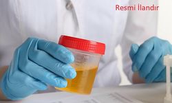 VAN YÜZÜNCÜ YIL ÜNİVERSİTESİ DURSUN ODABAŞ TIP MERKEZİNDE İDRAR TETKİKİ HİZMET ALIM İŞİ