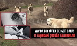 Van'da bir köpek saldırısı daha! Çocuğun vücudu parçalandı