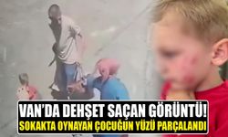 Van’da akılalmaz olay! Sokakta oynayan çocuğun yüzü parçalandı