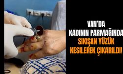 Van’da kadının parmağında sıkışan yüzük kesilerek çıkarıldı!