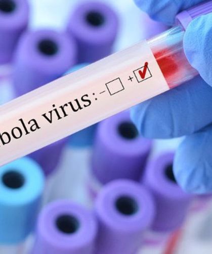 Ebola virüsü yayılıyor! Ebola virüsü nedir? Belirtileri nelerdir?