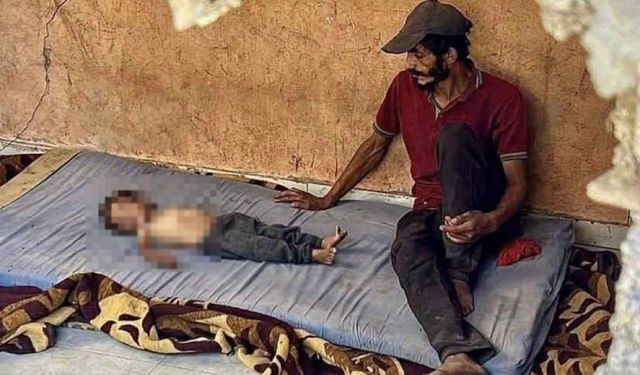 Gazze'de açlıktan şehit sayısı 124'e yükseldi