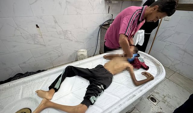 Gazze'de açlıktan yeni şehitler: Toplu ölüm uyarısı