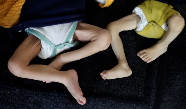 Gazze'de son 24 saatte 2’si çocuk 9 Filistinli açlıktan can verdi