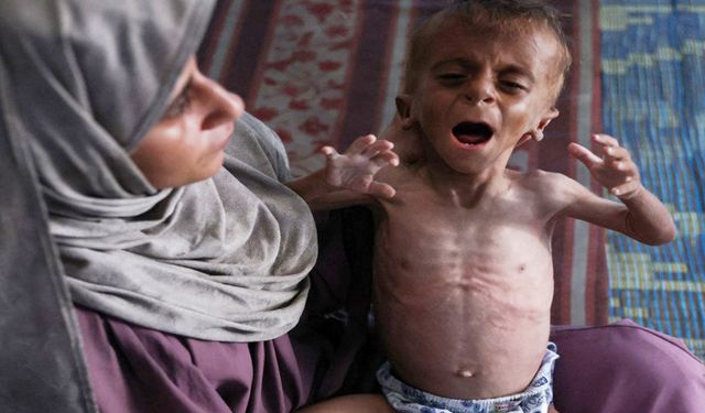 Gazze'de açlık çocukları vuruyor: Ot yemeye başladılar