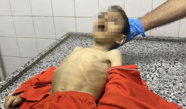 Açlık Gazze'de çocukları vurmaya devam ediyor: 3 günde 21 çocuk şehit oldu