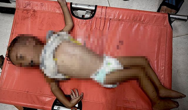 Gazze'de açlık nedeniyle sayısı 193'e yükseldi