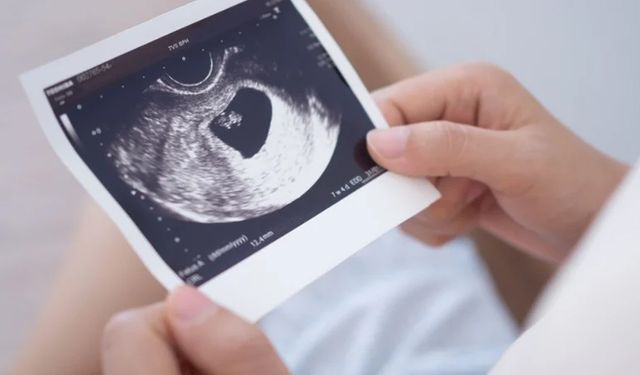 13 Haftalık Gebelikte Anne Ve Bebek: Neler Olur?