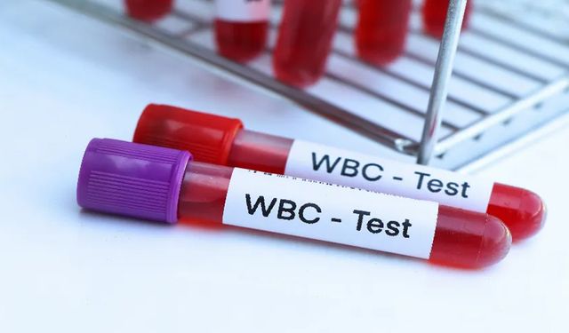 WBC Nedir? WBC Yüksekliği Ne Anlama Gelir?