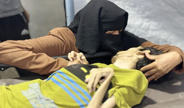 Gazze'de açlıktan ölenlerin sayısı 399 oldu