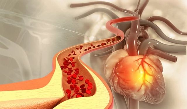 Kolesterol belirtileri nelerdir?