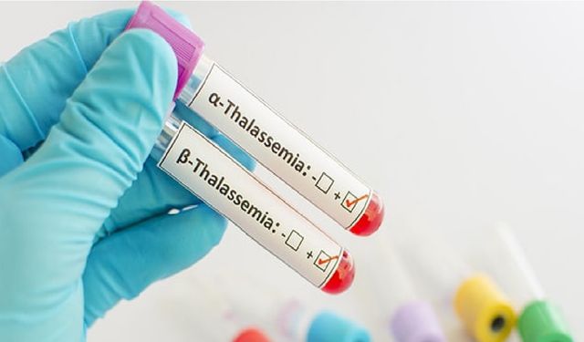 Uzmanlardan Vanlılara Talasemi uyarısı!