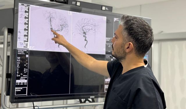 Van’da ilk kez: Beyin anevrizması ameliyatsız tedavi edildi