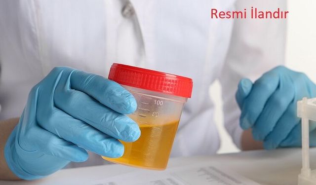 VAN YÜZÜNCÜ YIL ÜNİVERSİTESİ DURSUN ODABAŞ TIP MERKEZİNDE İDRAR TETKİKİ HİZMET ALIM İŞİ