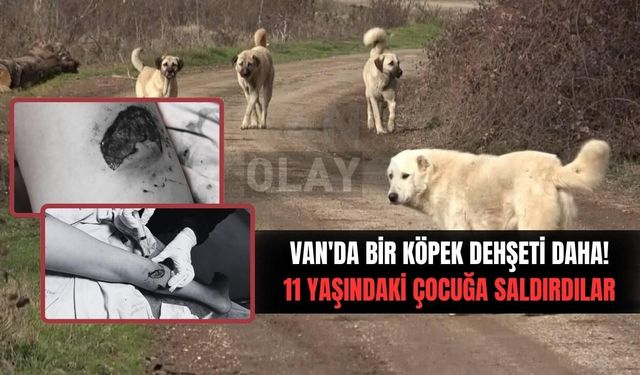 Van'da bir köpek saldırısı daha! Çocuğun vücudu parçalandı
