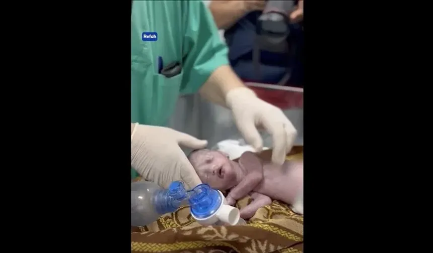 İşgalcilerin katlettiği Filistinli hamile kadının bebeğini Gazzeli doktorlar kurtardı