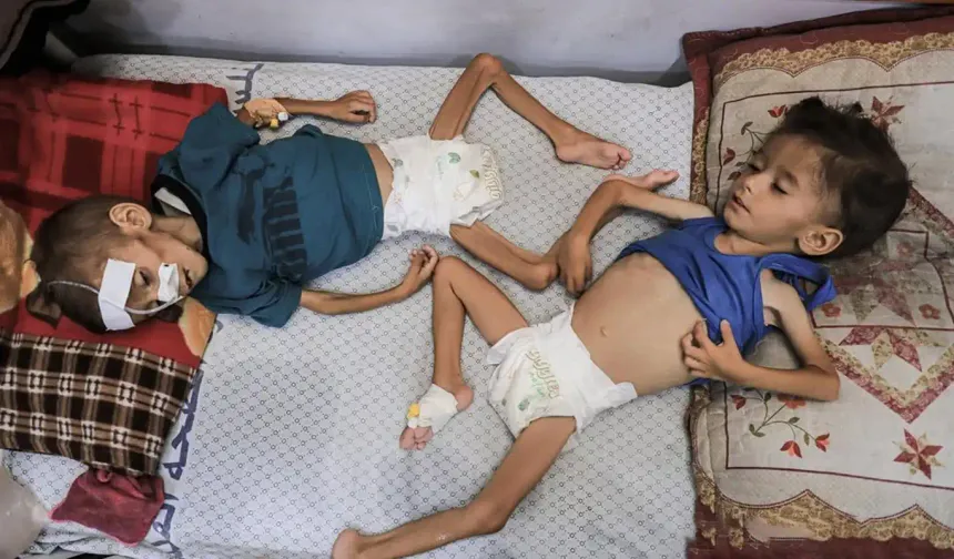 Gazze'de 18 bin çocuk açlıkla boğuşuyor