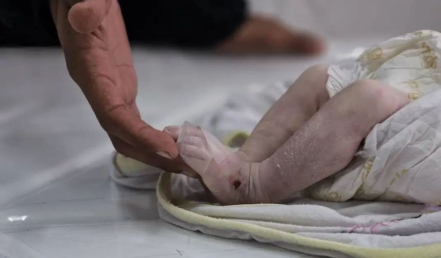 Gazze’de günde7 Filistinli açlıktan  ölüyor
