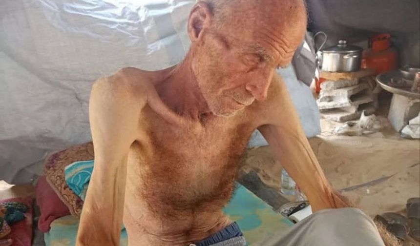 Gazze'de  insanlar açlıktan ölüyor