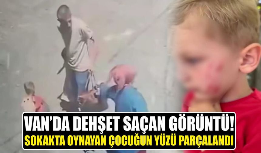 Van’da akılalmaz olay! Sokakta oynayan çocuğun yüzü parçalandı
