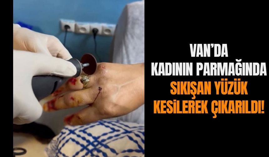 Van’da kadının parmağında sıkışan yüzük kesilerek çıkarıldı!