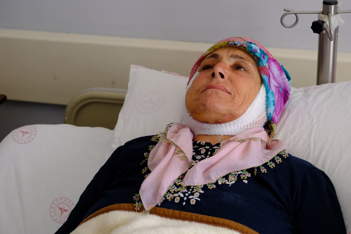 Türkiye’de Ilk Kez Van'da Yapıldı 15 Yıllık Yüz Felci Ameliyatla Düzeldi (5)