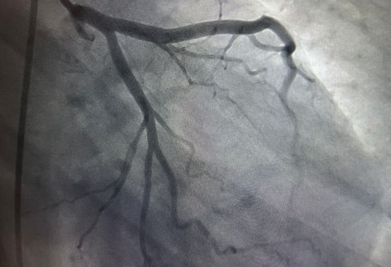 Başhekimden Van’daki Kalp Hastaları Için Kritik Ramazan Uyarısı! (4)