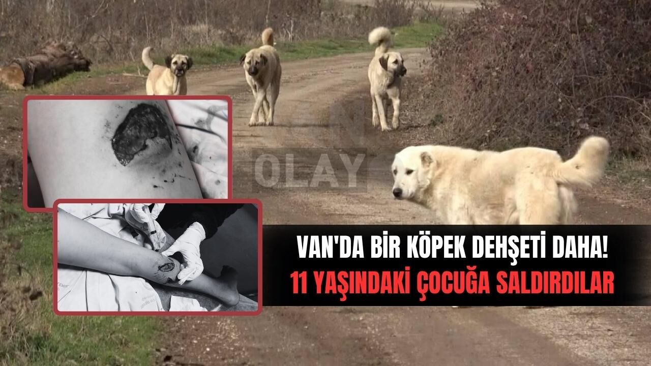 Van'da bir köpek saldırısı daha! Çocuğun vücudu parçalandı