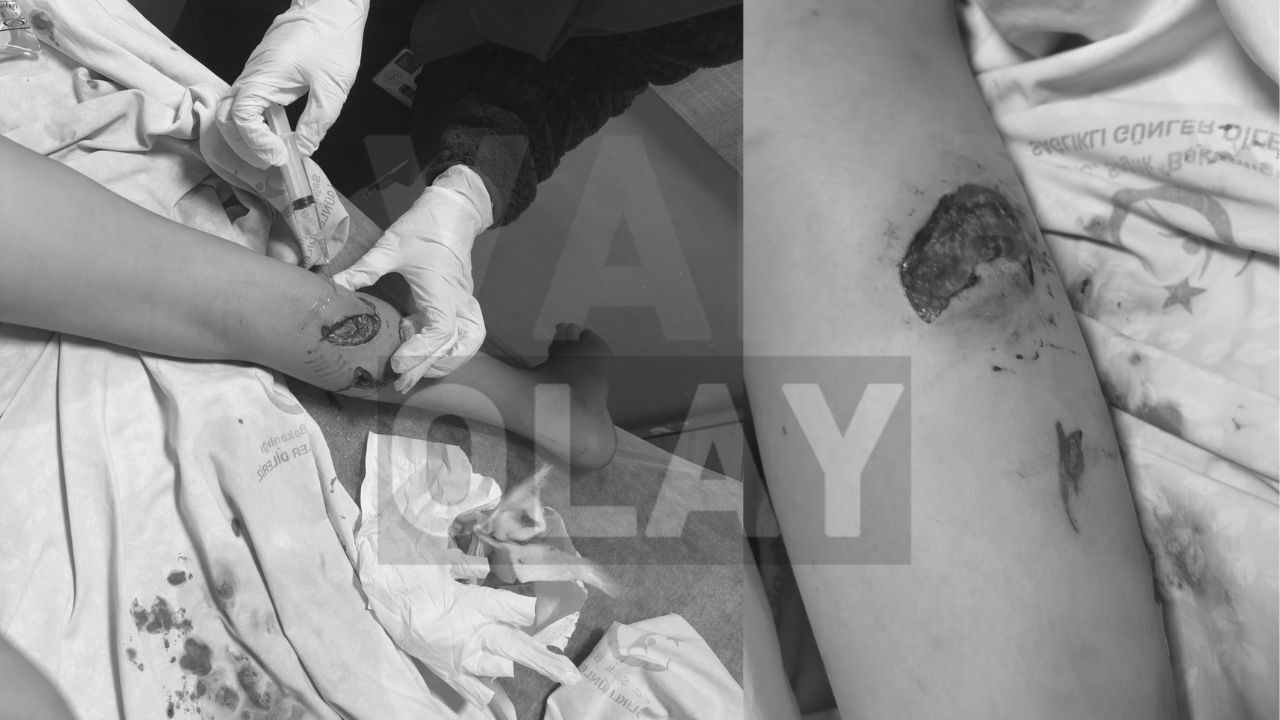 Van'da Bi̇r Köpek Dehşeti̇ Daha! 11 Yaşindaki̇ Çocuğa Saldirdilar 20260508 210636 0000